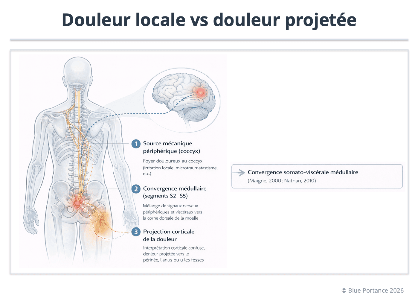 Douleur locale coccygienne versus douleur projetée vers le périnée et les fesses, avec voies nerveuses impliquées