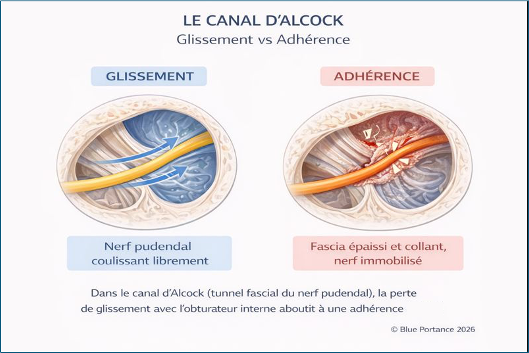Canal d’Alcock et fascias : comparaison entre glissement libre du nerf pudendal et restriction de mobilité liée à des fascias rigidifiés.
