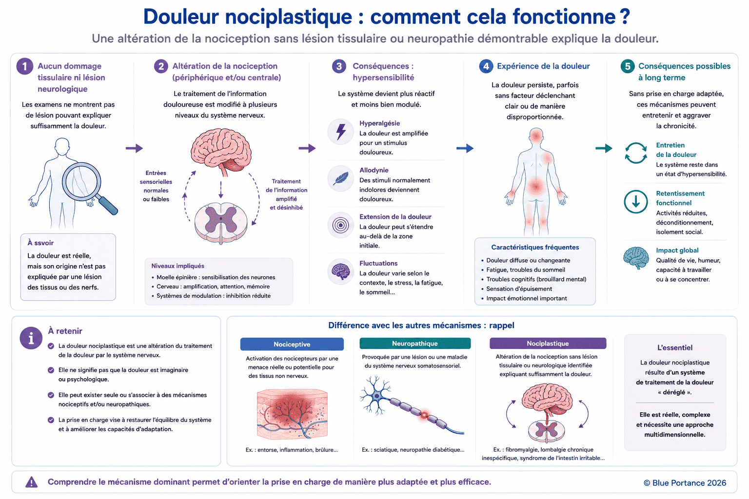Schéma de la douleur nociplastique montrant une altération de la nociception, une hypersensibilité du système nerveux, une amplification des signaux et une douleur insuffisamment expliquée par une atteinte tissulaire ou neurologique.