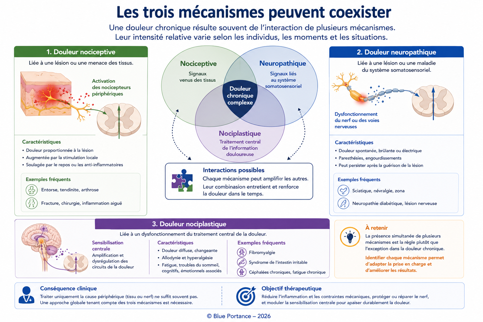 Schéma montrant que les mécanismes nociceptif, neuropathique et nociplastique peuvent coexister dans une même douleur chronique.