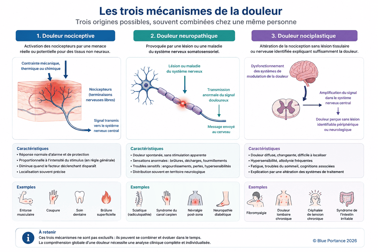Les trois mécanismes biologiques de la douleur : nociceptif, neuropathique et nociplastique.