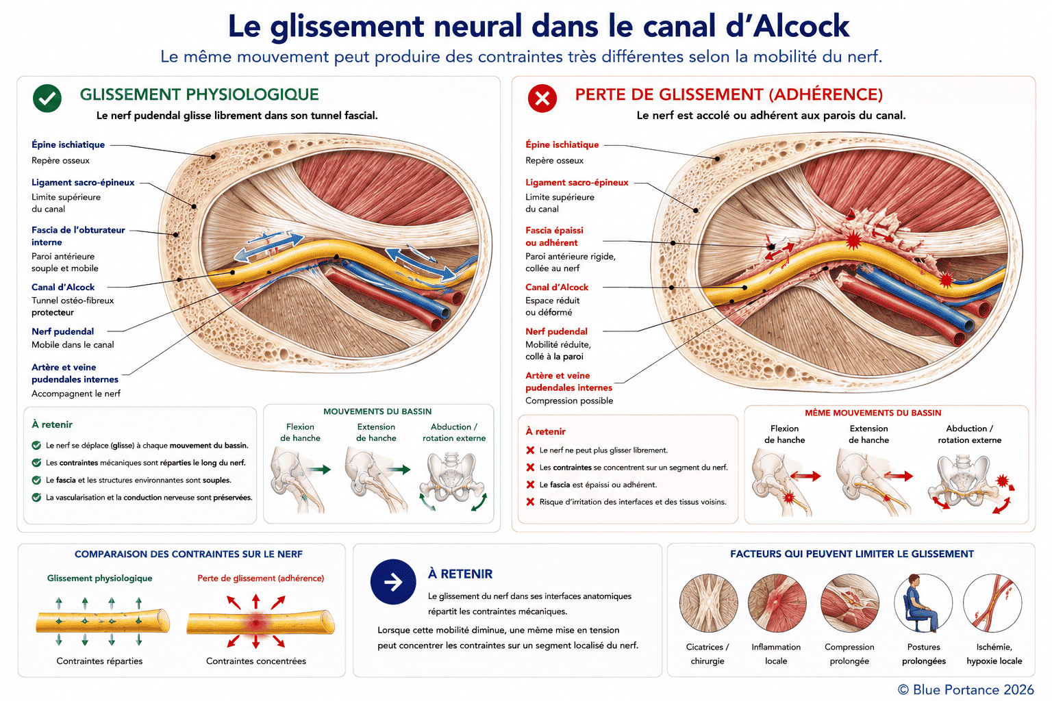 Comparaison entre un glissement normal du nerf pudendal dans le canal d'Alcock et une perte de glissement liée à des adhérences fasciales.