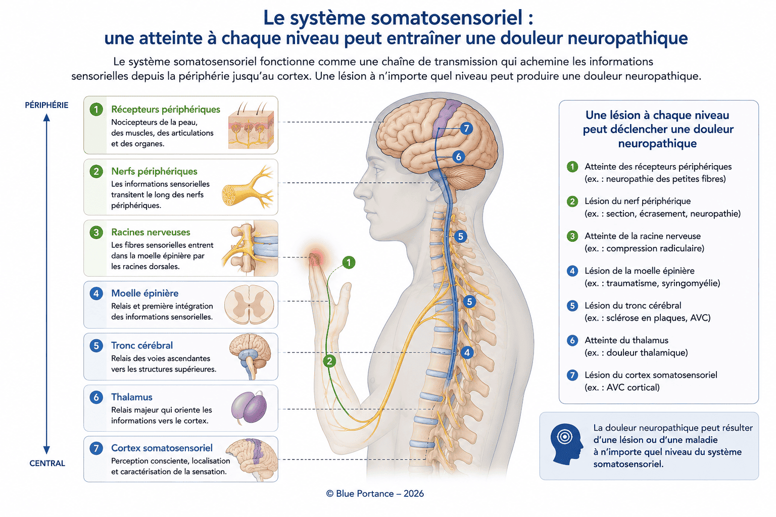 Schéma du système somatosensoriel montrant où peut apparaître une douleur neuropathique.