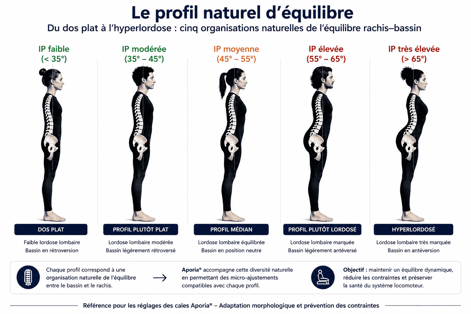 Le profil naturel d’équilibre selon l’incidence pelvienne : du dos plat à l’hyperlordose
